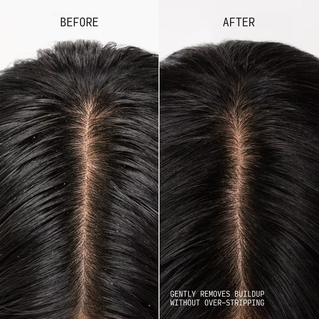 Clarifying Shampoo & Scalp Scrub
